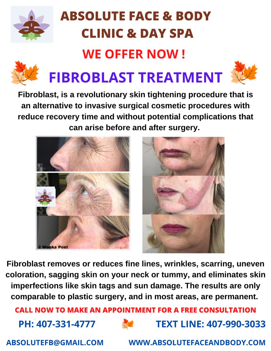 AbsoluteFB_Spa's tweet image. 