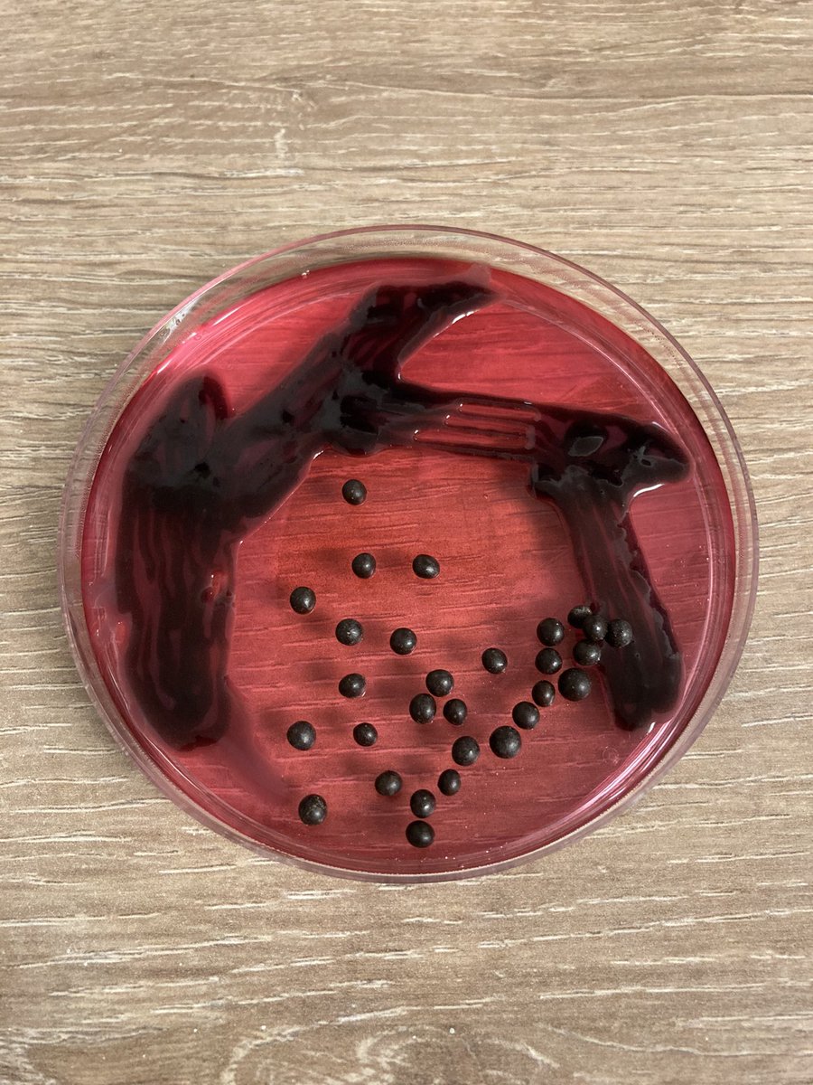 spange1979's tweet photo. #IBMSCompetition #biomedicalbakes @NuTHPathology @Jinebo Guess the bugs on homemade edible fruit jelly agar!! 🧫 https://t.co/E2ZrQZPfPK