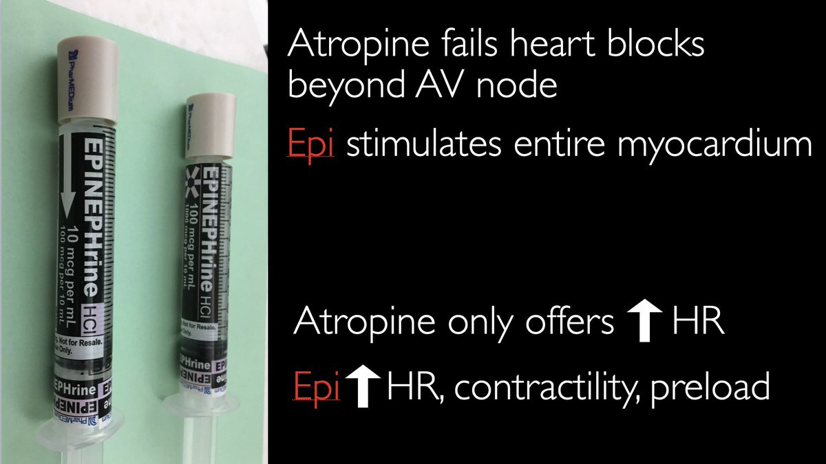 SonoSnowbunny's tweet photo. Discussing approach to bradycardia #UVMdidactics: consider treatable causes (ischemia, Lyme, hyperK), echo structural abnormalities, & move towards pacing in 3rd degree, high grade & Mobitz II AV blocks. Push dose epi over atropine in peri-arrest. Great summary @PulmCrit #UVMEM https://t.co/OuGTkv66sj