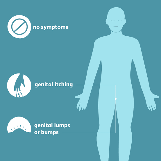 comm3724_tilo's tweet photo. Signs and symptoms of HPV are shown on the picture:
.Sometimes no symptoms, that is in HPV that usually clears on its own
. Genital Warts
. Itching on the genitals

Ever experienced this symptoms after unprotected sex..might be HPV..get tested https://t.co/fiaTLPdOFL