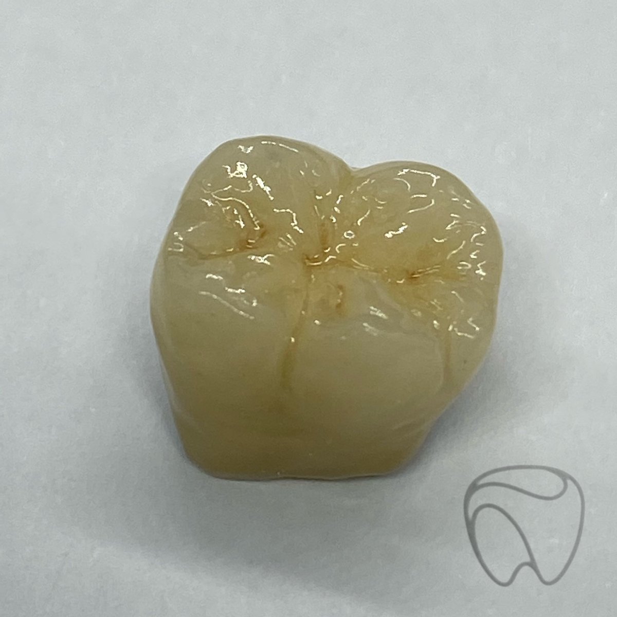 LabExcellence's tweet photo. A lovely bonded crown created by one of the talented ceramists at Dental Excellence 

#dentistry #dentist #dentalart #dentallab #dentallaboratory #ceramics #ceramicart #dentaltechnician #teeth https://t.co/rhGNnuJBBi