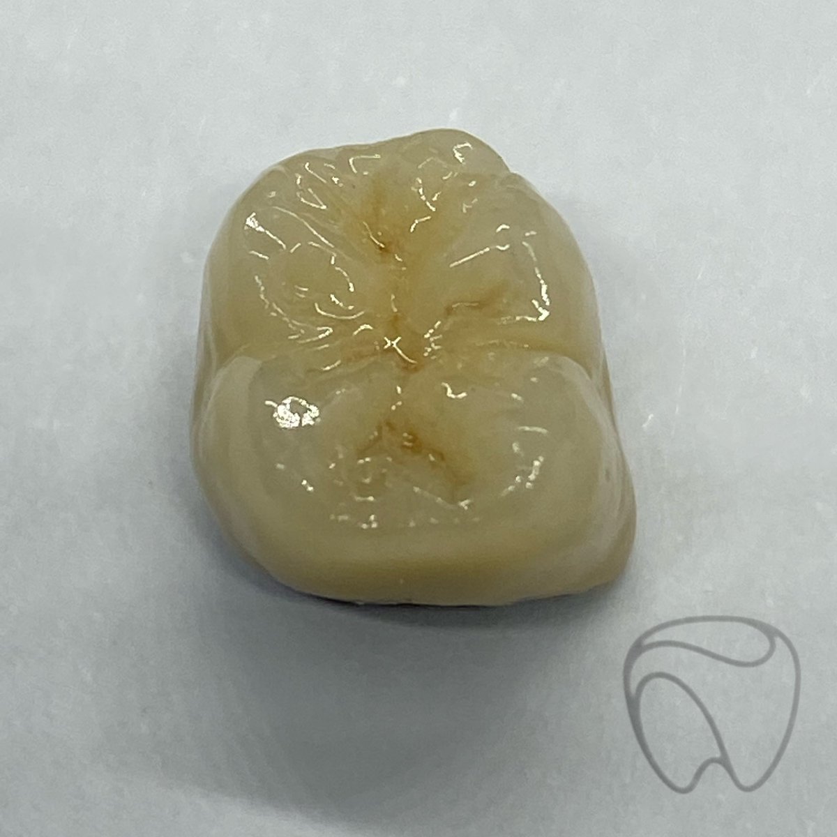 LabExcellence's tweet photo. A lovely bonded crown created by one of the talented ceramists at Dental Excellence 

#dentistry #dentist #dentalart #dentallab #dentallaboratory #ceramics #ceramicart #dentaltechnician #teeth https://t.co/rhGNnuJBBi