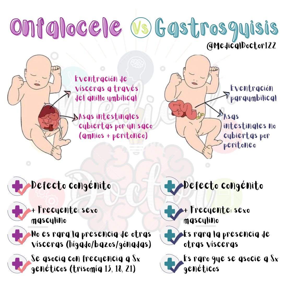 MedicalDoctor12's tweet photo. Onfalocele VS gastrosquisis https://t.co/XtCb3dPYoY
