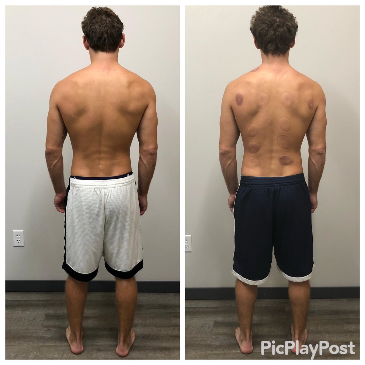 MOVEWELLIOWA's tweet photo. Results matter. Reach out if you went to get out of pain, move better, feel better and live better.
@Boomhowser101 pain is diminishing and now 3.9 MPh faster than when he first came in!
#functionalpatterns #fpresults #movewelliowa #ankeny #ankenyiowa #DesMoines https://t.co/YU67QQtuGj