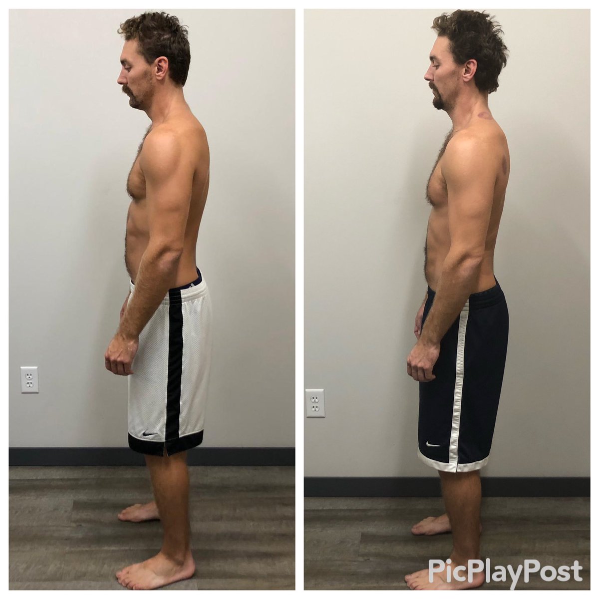 MOVEWELLIOWA's tweet photo. Results matter. Reach out if you went to get out of pain, move better, feel better and live better.
@Boomhowser101 pain is diminishing and now 3.9 MPh faster than when he first came in!
#functionalpatterns #fpresults #movewelliowa #ankeny #ankenyiowa #DesMoines https://t.co/YU67QQtuGj