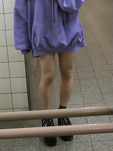 墓みょ 過食激太り 左 から今 右 のビフォアフ 2年かけて14キロ落とした 泣いたり過食したり食事制限したり脂肪吸引 計3回 したり引きこもったりエアロバイクジム通ったりパーソナル通ったりしながらなんとか標準体重まで戻した 標準体重から半年で17キロ