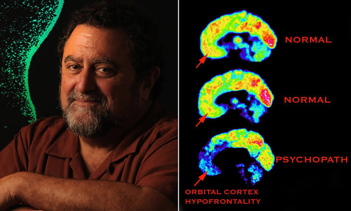 джеймс фэллон психопат. джеймс фэллон. джеймс фэллон психопат. джеймс фэллон. James fallon психопат.