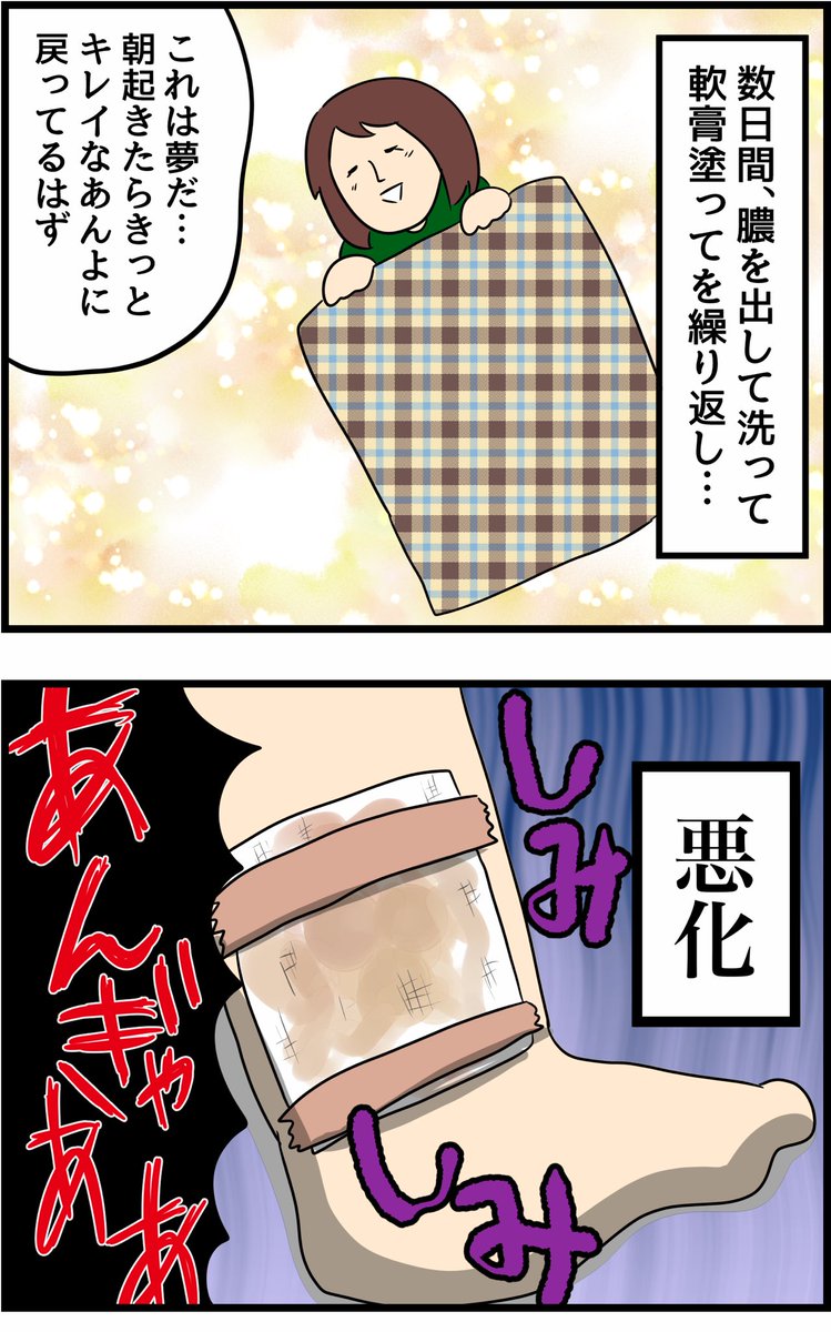 オペ室で働いてた頃の話⑨【閲覧注意】 
