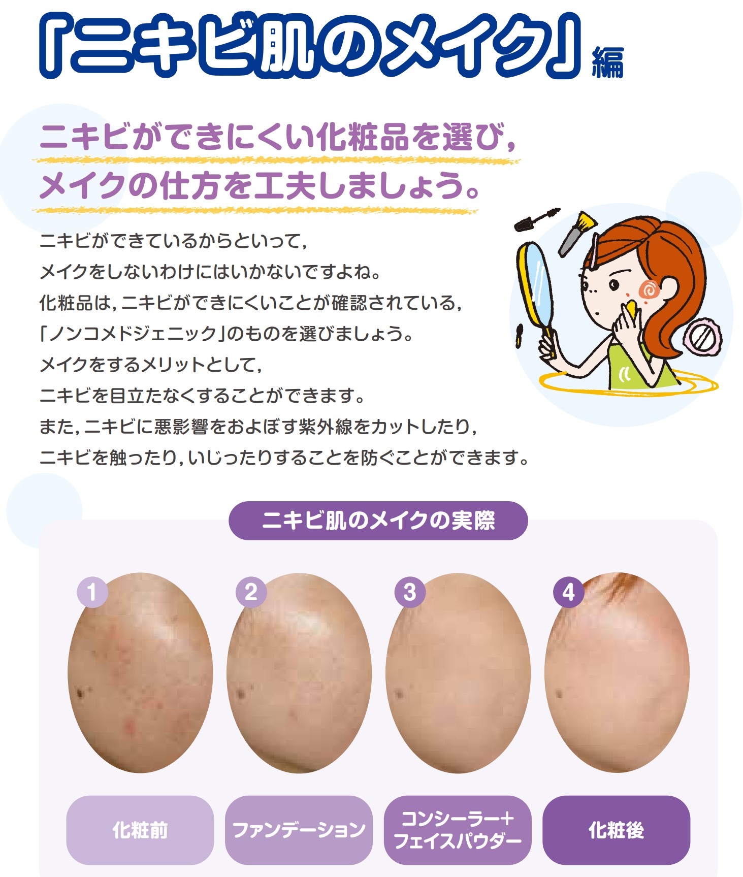 やさしい皮膚科医 ニキビ肌のメイクのコツ ノンコメドジェニックテスト済製品を選ぶ 毛穴が詰まりにくい製品を 補色を活用し悩みを隠す 赤ニキビ グリーン下地 ニキビ跡のくすみ イエロー下地 ポイントメイク 頑張るのはニキビと無関係な目や口