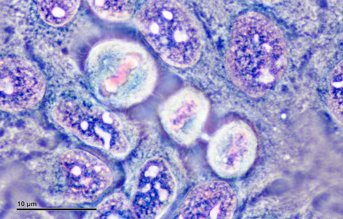 Radio3scienza's tweet photo. "Ogni cellula può moltiplicarsi un certo numero di volte prima di morire per #apoptosi: una morte cellulare programmata. Le cellule tumorali invece sono #immortali nel senso che non hanno questo sistema di regolazione, non hanno un limite al di duplicazioni" #MarialuisaLavitrano https://t.co/dHRJ4N8gIj