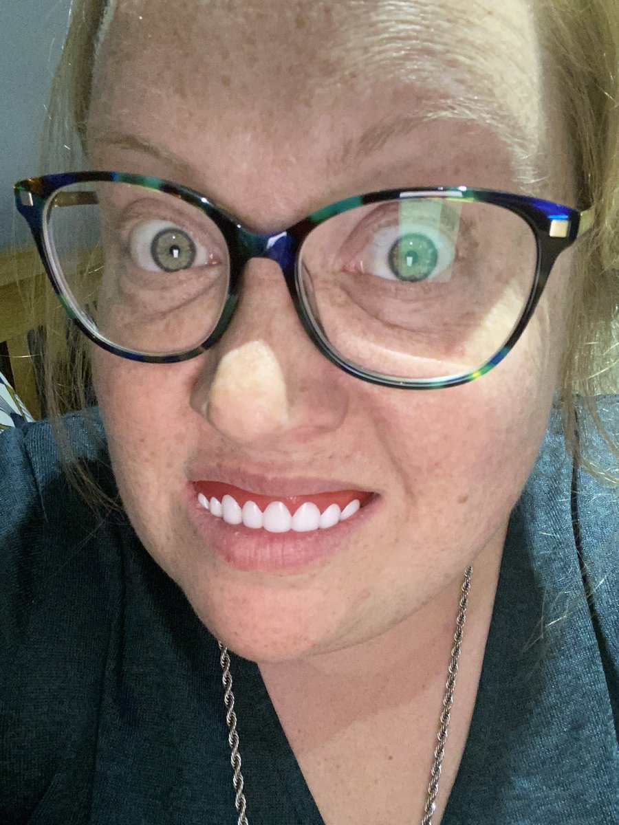 CarolineVerdon's tweet photo. What’s that? What’s the worst thing i’ve bought in lockdown? Hands down it’s these “Natural veneers” #notfancydress #veneers #perfectsmileveneers #thinkillpass https://t.co/WDSdpkp4OD