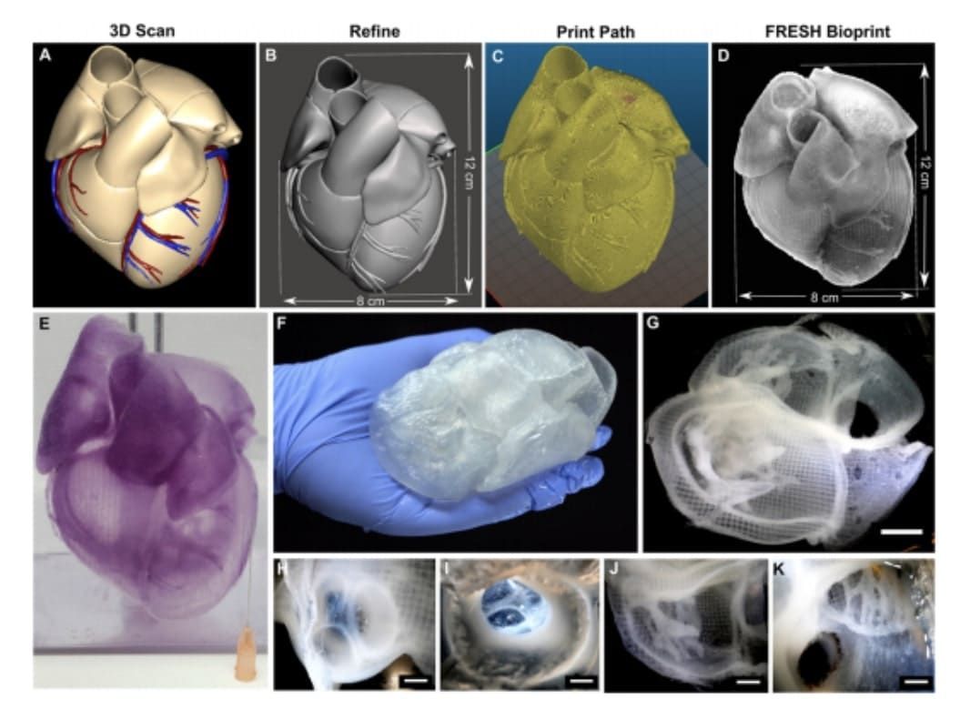 3dheals's tweet photo. #FromAcademia #3DBioprinting The #Heart &amp; #Cardiovascular System
https://t.co/Qp5aVqipGJ In this issue, we included three recent publications all focusing on 3D bioprinting the heart.  @cllbrcks @FluidForm3D @VolumetricBio @Axolotl_Biosci https://t.co/uZjZWLMvS0