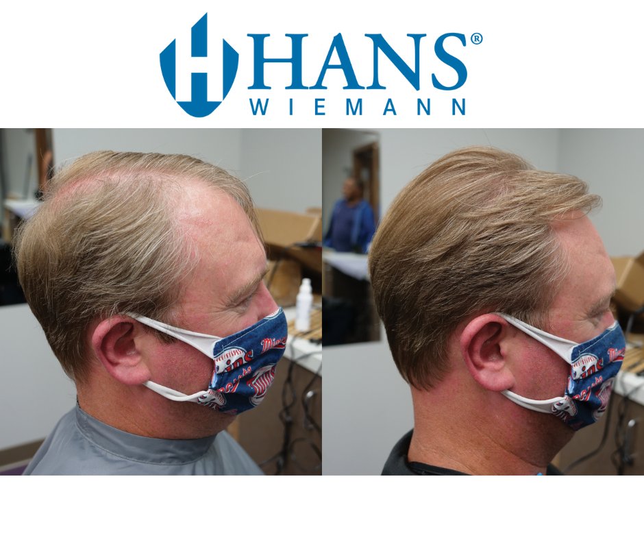 Do you want a low-commitment option for your hair loss? #StrandBuilder features 100% natural Keratin fibers that cling to your existing hair. Call #Hans today for a free demo! 800-869-2850 bit.ly/3k5jtwr