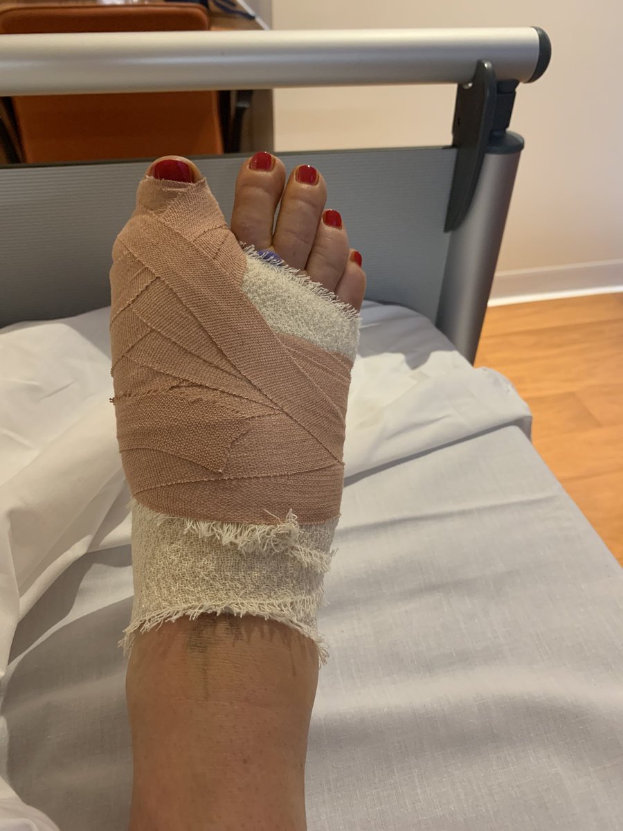 bes502's tweet photo. Surgery completed and went well... I’ve been told to rest which is going to be tough but hopefully back running in two weeks. Have a great weekend everyone. #SleepyGirl #MustRest #Recovery @ShrillaB https://t.co/GxouuwDYW1