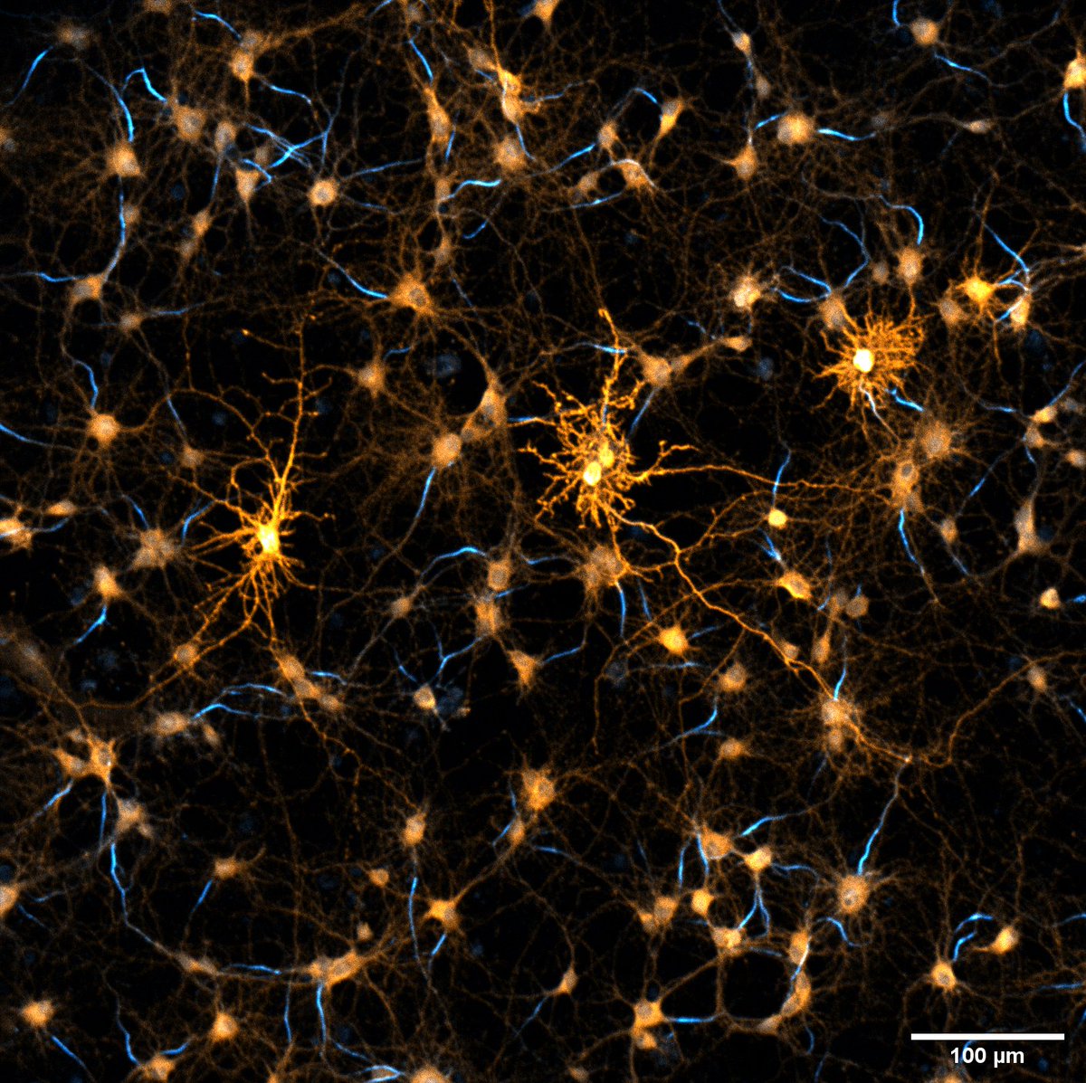 Abberior's tweet photo. Neurons are so beautiful! Confocal image (10x) of neuronal cultures acquired with our #INFINITYLINE. Some cells are overexpressing betaII spectrin (orange, STAR635P), axons are identified by Ankyrin G (blue, Alexa488). Thanks @ElisaDEste for the amazing image! #fluorescencefriday https://t.co/XSUHW7Nyj1
