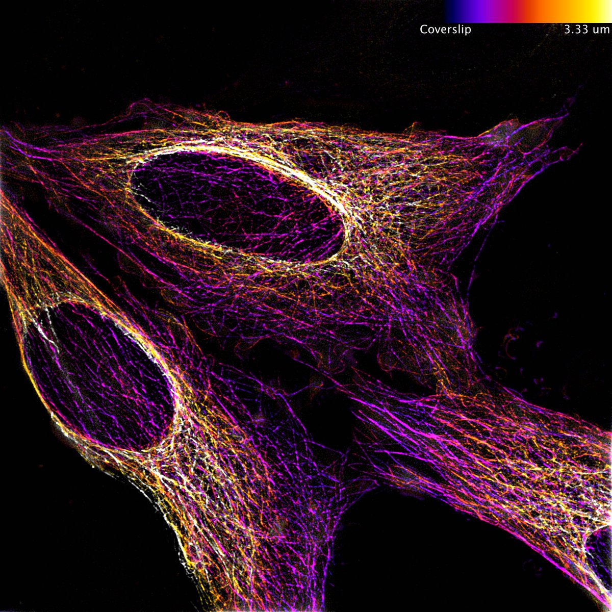 Cambridge Advanced Imaging Centre (@cammicroscopy) on Twitter photo October image of the month is from <a href="/Ruby_Peters_/">Dr. Ruby Peters</a> of the
<a href="/PaluchLab/">Ewa Paluch 🇺🇦</a> and shows HeLa cells, labelled with Tubulin-GFP. Taken using our Elyra 7 Lattice SIM and colour coded for depth October image of the month is from <a href="/Ruby_Peters_/">Dr. Ruby Peters</a> of the
<a href="/PaluchLab/">Ewa Paluch 🇺🇦</a> and shows HeLa cells, labelled with Tubulin-GFP. Taken using our Elyra 7 Lattice SIM and colour coded for depth
