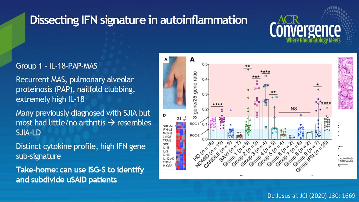 Dissecting IFN signature in autoinflammation https://pubmed.ncbi.nlm.nih.gov/31874111/&nbsp;ISG-S screen in unidentified autoinflammation, n=664 new entities1 - IL-18-PAP-MAS2 - LRBA deficiency3 - NEMO4 - SAAD #ACR20  #ACRambassador