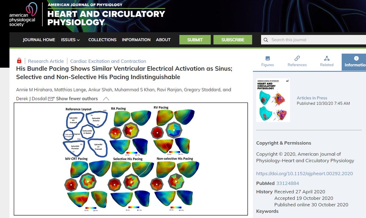 ajpheartcirc's tweet photo. #ArticlesInPress His Bundle Pacing Shows Similar Ventricular Electrical Activation as Sinus; Selective and Non-Selective His Pacing Indistinguishable
https://t.co/Pgec155jqD
@UUtah
#Hisbundlepacing #pacemaker #Purkinje #cardiacresynchronization https://t.co/9uUAKjSGHF