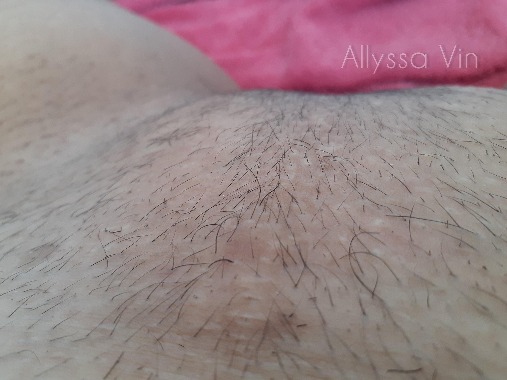 Quem gosta de pelinhos? https://t.co/2G5kFhr3qz