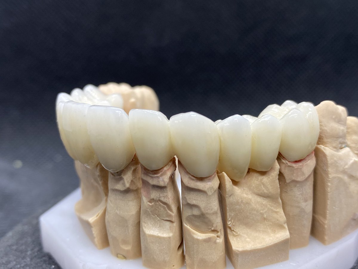 LabExcellence's tweet photo. #dental #dentist #dentallab #zirconia https://t.co/Z1AZLIDCAt
