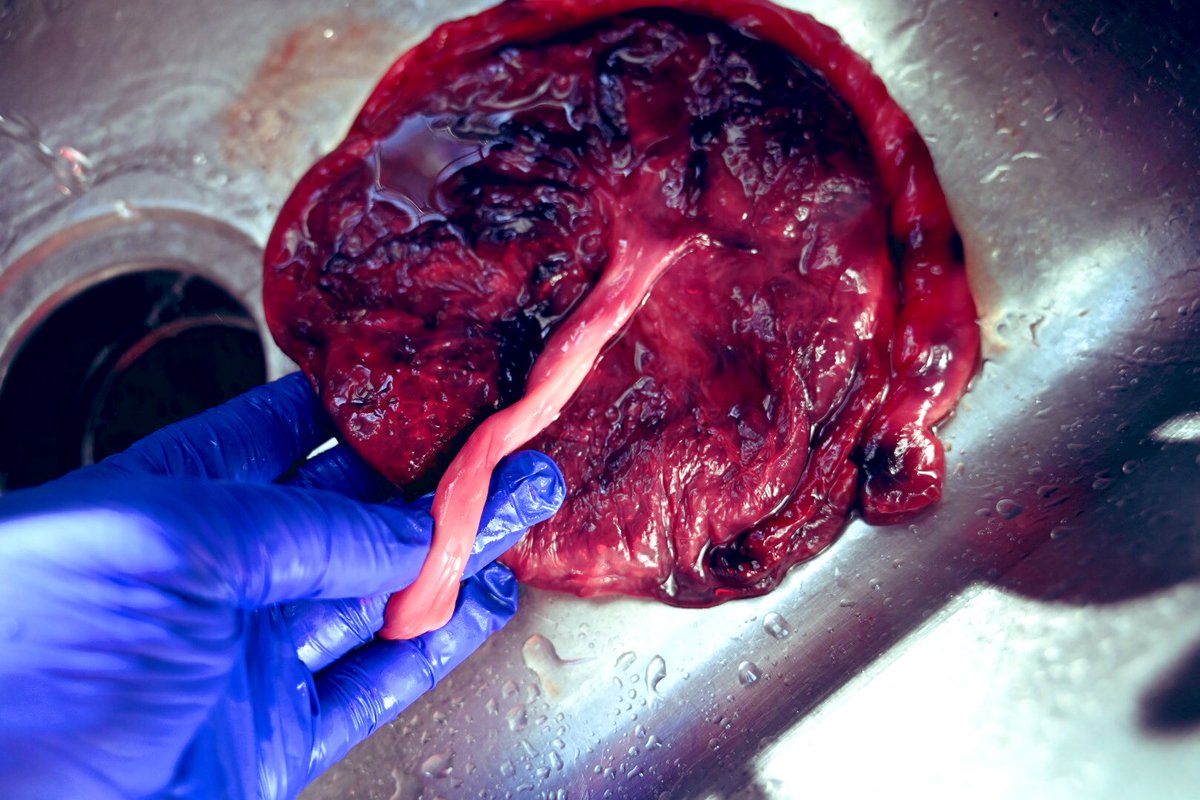 douladeeds's tweet photo. I’m a whole medicine woman out here. My hands are here to work, nurture, & heal. I share that in the most humblest of ways. Thank you to every mama that ever let me be a part of her birthing journey. The placenta is your first home. Imagine that. #PlacentaEncapsulation https://t.co/1WD6hKobFj