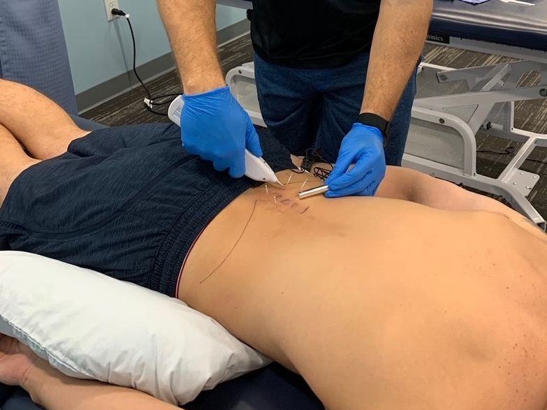 IAMT 2021 Courses - Looking for Dry Needling Course Hosts conta.cc/3ewpgcY