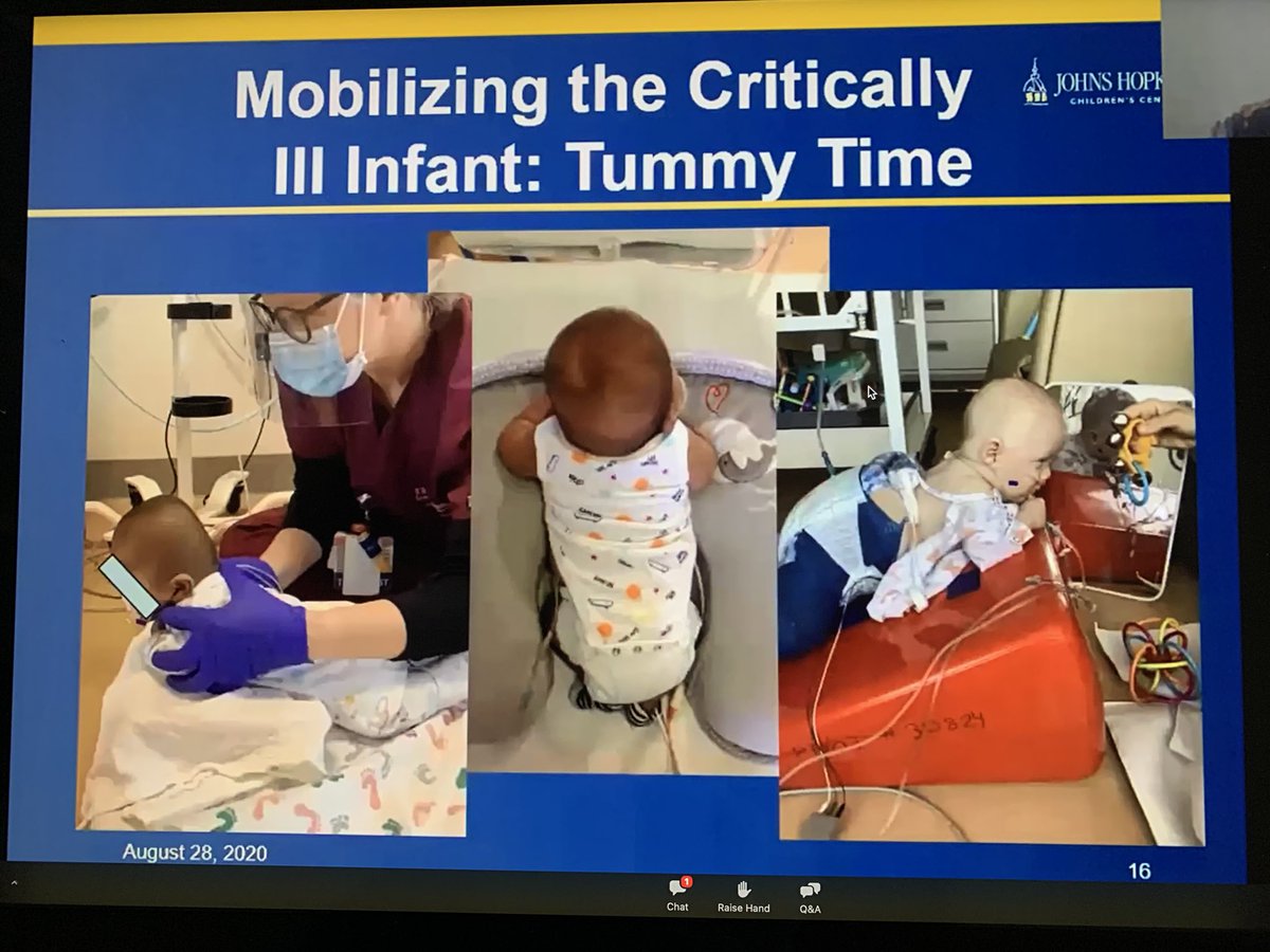 mj_manning's tweet photo. Critically ill Infants and toddlers need early mobility and proper stimulation to encourage proper development. @PICU_Up @icurehab #IllnessDoesntMeanStillness #everyBODYmoves @BostonChildrens #PedsICU #bedrestisbad #ICURehab https://t.co/3BWWju8AVV