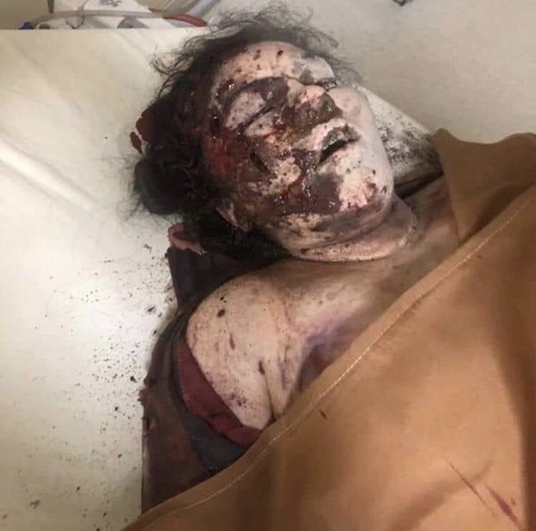 Is <a href="/NikolPashinyan/">Nikol Pashinyan</a> a fascist? <a href="/Pashinyan/">Pashinyan</a> is THE fascist who commits crimes against humanity. He commands SCUD missiles to be fired on sleeping civilians. #aggressorArmenia