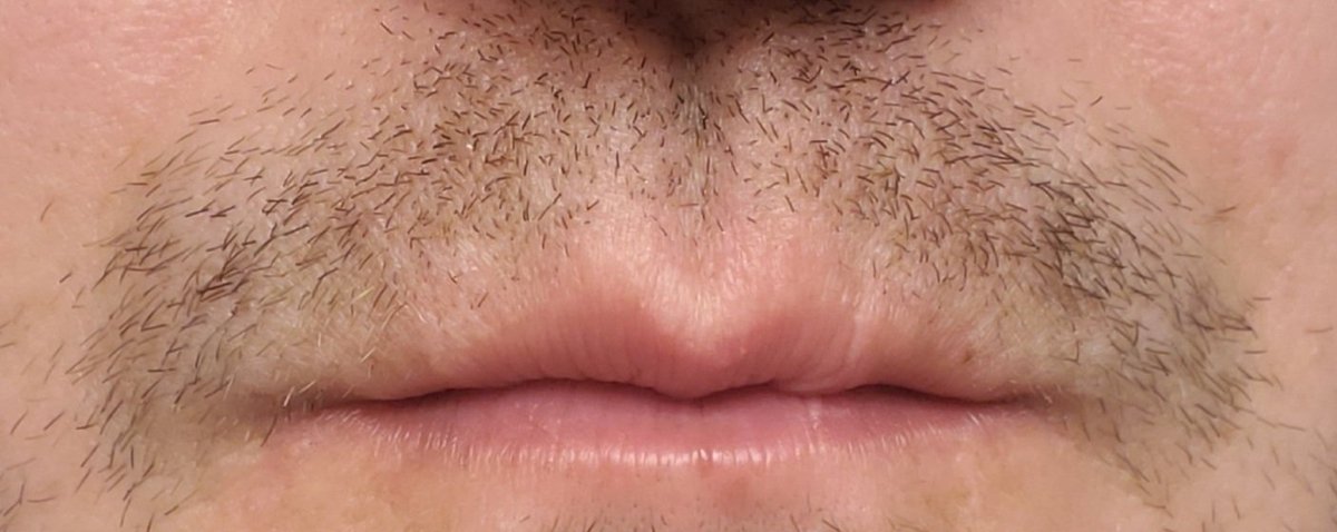 DougCheckley's tweet photo. Got a ways to go, but 6 days in we're sprouting! Huge shout out to my partner @jmarcotte85 for raising a ton of money for the cause through her selling her prints! #movember #uledwellness #uletheduMocation https://t.co/AXxbXf8OaW