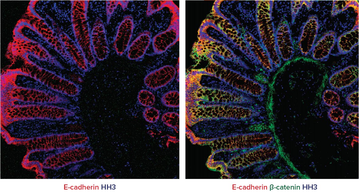 Standard_BioT's tweet photo. What is #ImagingMassCytometry and why should I care? Join Dr. Jared K. Burks, PhD, at @MDAndersonNews on Nov 11, 1:00pm ET, as he introduces the power of the #technology and how it can revolutionize your ability to understand cell-cell interactions.
https://t.co/csVxrXtABT https://t.co/ozxh6HI3mt