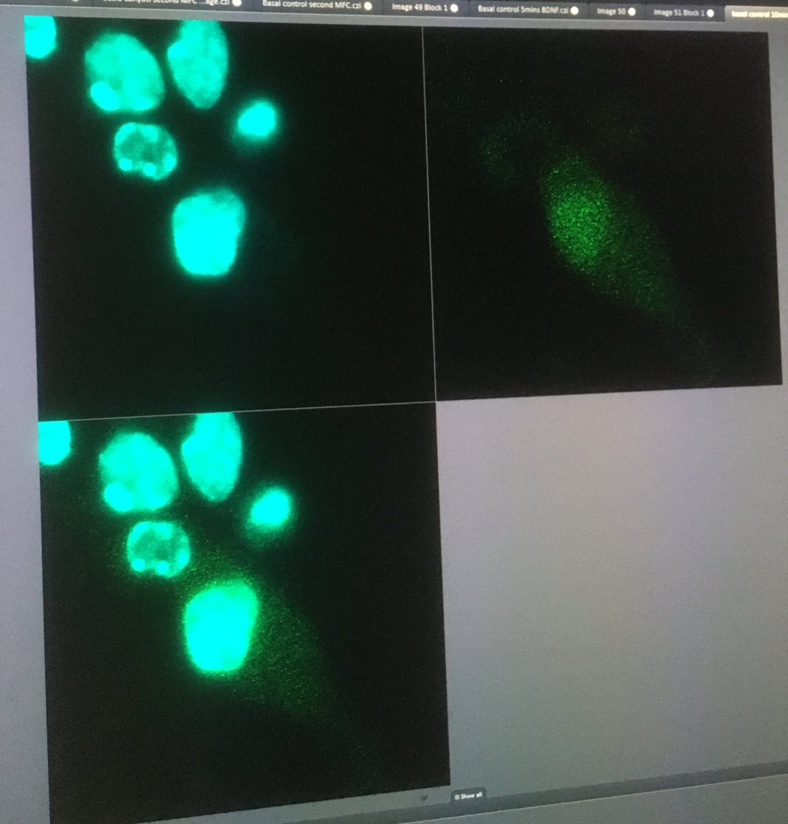 Here we are squeezing <a href="/rachconeys/">Rachel Coneys</a>’s PhD rotation until the very last minute and waiting to see whether this neuron responds to retrograde BDNF signalling. #ExcitingButSlowScience #KinaseTranslocationReporter #Microuidics