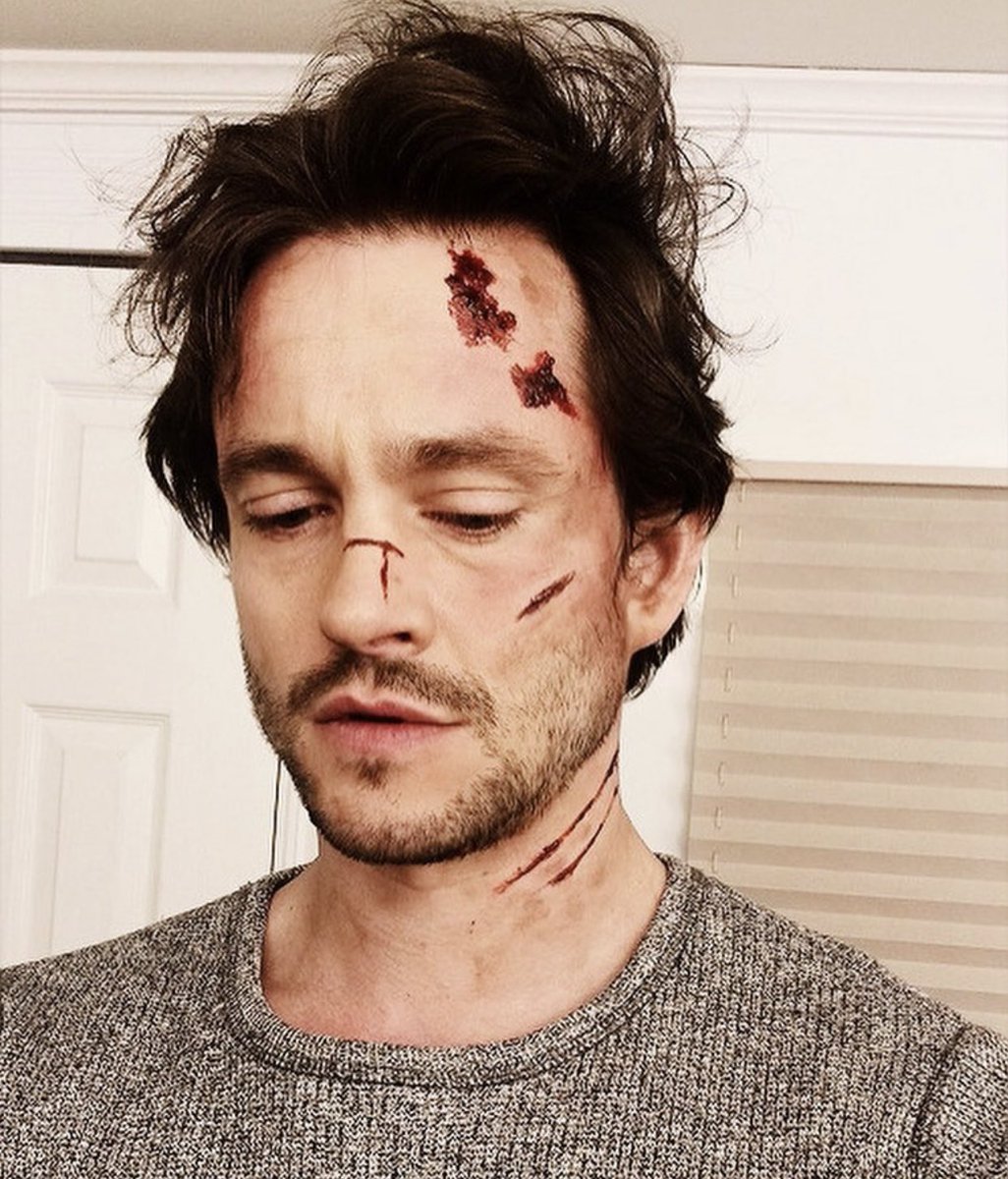 scuffed up baby. let me tend to your wounds and comb your hair and kiss u gently. pls.