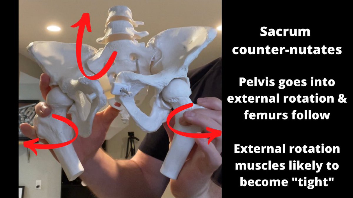 When hips are wider, the sacrum is in a relatively higher amount of counter-nutation and the pelvic bones follow it into:- External rotation- Abduction- Flexion