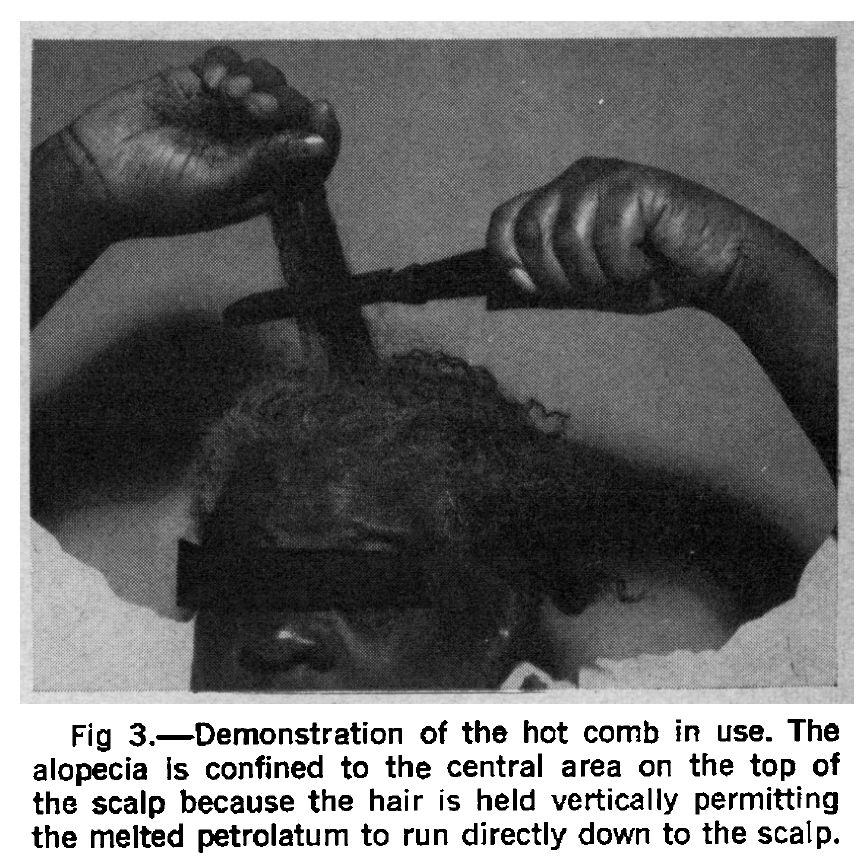 The authors even included figures in the manuscript of a hot comb and a Black woman straightening her hair. LMAO.