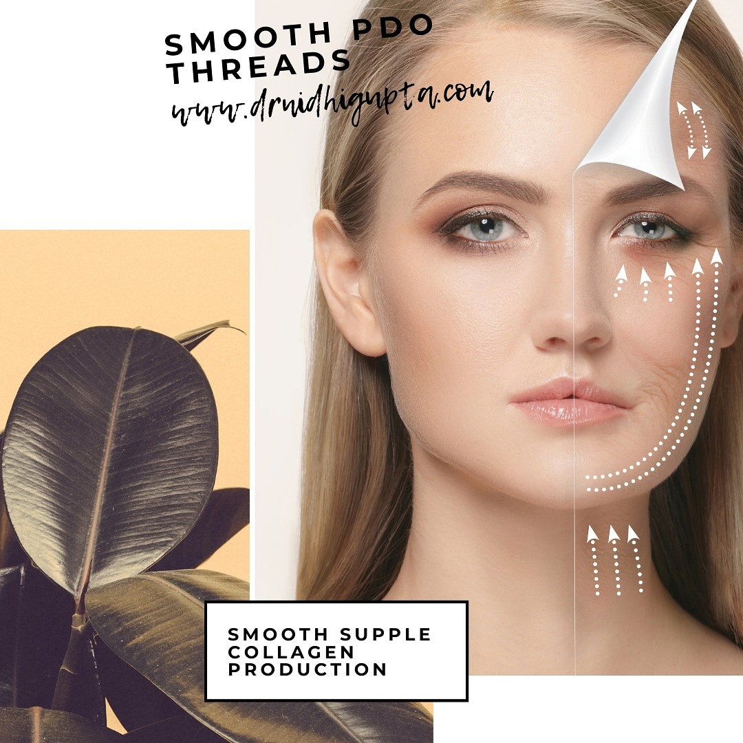 DRNIDHIGUPTA_MD's tweet image. SMOOTH PDO THREADS!!

For more info👇👇
drnidhigupta.com

#PDOthreads #smooththreads #collagen #antiageing #notovolumeloss #beauty #drnidhigupta #wrinklefree #youthforever #koreanfinish
