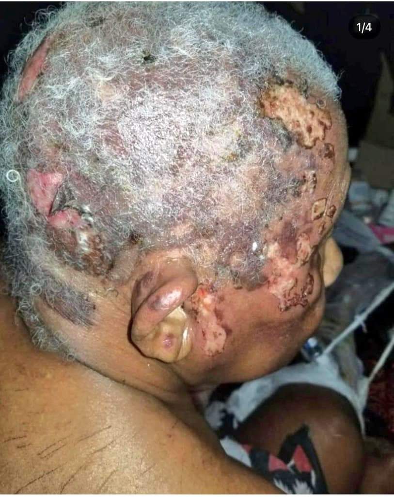 IddyMayeye's tweet photo. Hiki ni Kitanda cha Bibi Sada Ali Hassan aliepigwa Bomu ndani mwake siku ya tarehe 27/10/2020 maeneo ya Garagara. M/kiti wa chama cha @ACTwazalendo Maalim @SeifSharifHamad amefika asubuhi hii kuijulia hali familia hiyo na kuwafariji waathirika wa tukio hilo.
#hakiYetuWazanzibar https://t.co/lPn6dgMiRS