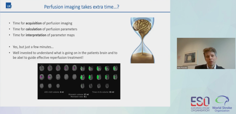 WorldStrokeEd's tweet photo. #ESOWSO2020 LIVE session: 
⚡️Controversies 1 -#thrombectomy 

Do We Need Perfusion #imaging to Guide MT In Extended Time Window? - YES says #GoetzThomalla @WAKEUPstroke 

#DAWN #DEFUSE3 #ESMINT @StrokeAHA_ASA @ESOstroke @WorldStrokeOrg https://t.co/9NdFVXhtgJ