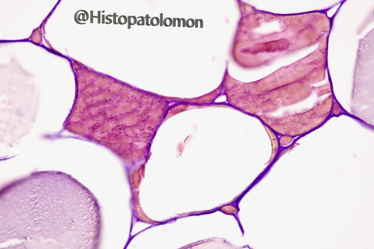 Histopatolomon's tweet photo. In addition to the banana, there are other foods that have fish scale structures, reminiscent of sevelamer. Can you tell me what food these microscopic pic are of? #pathology #foodunderthemicroscope @Meghna0630 @oreoimc @ijexpafo @yro854 @nucleololailo @Alipathy @martiponi #food https://t.co/6zx4Qc6L3m