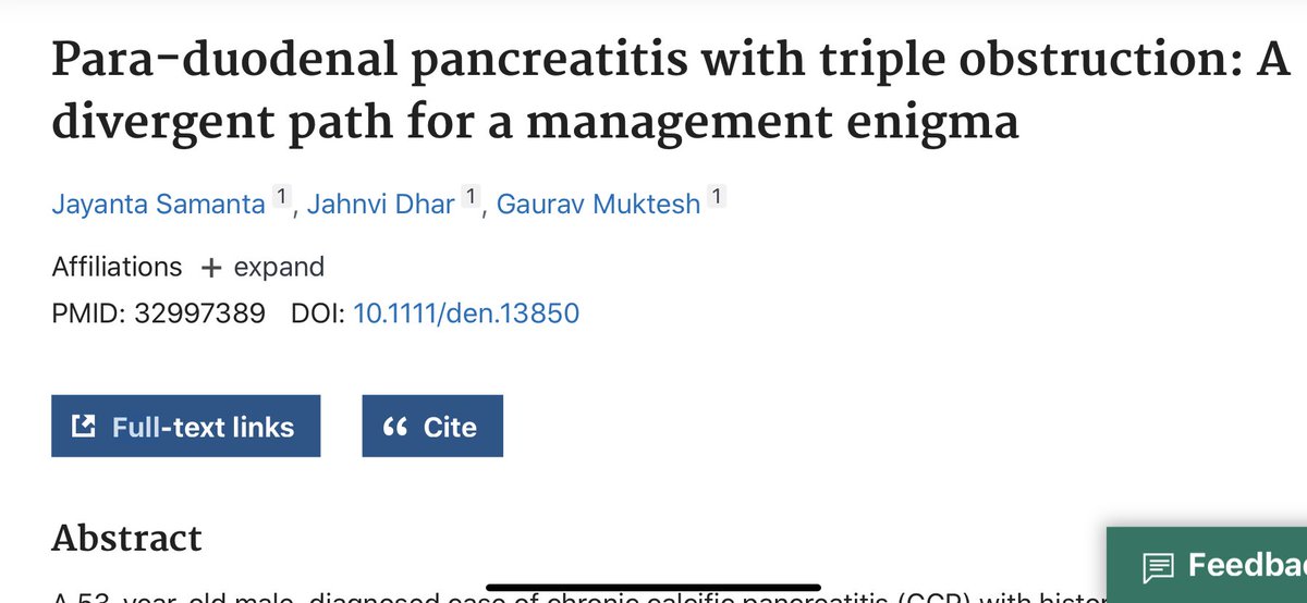 GauravMuktesh's tweet photo. A case of paraduodenal pancreatitis with triple obstruction (biliary stricture, duodenal stenosis and pancreatic stricture) underwent successful eus guided biliary drainage and eus guided pancreatic drainage. Doing well. 
#eusbd #euspd #pancreatitis #digestiveendoscopy https://t.co/iheC9AwKbh