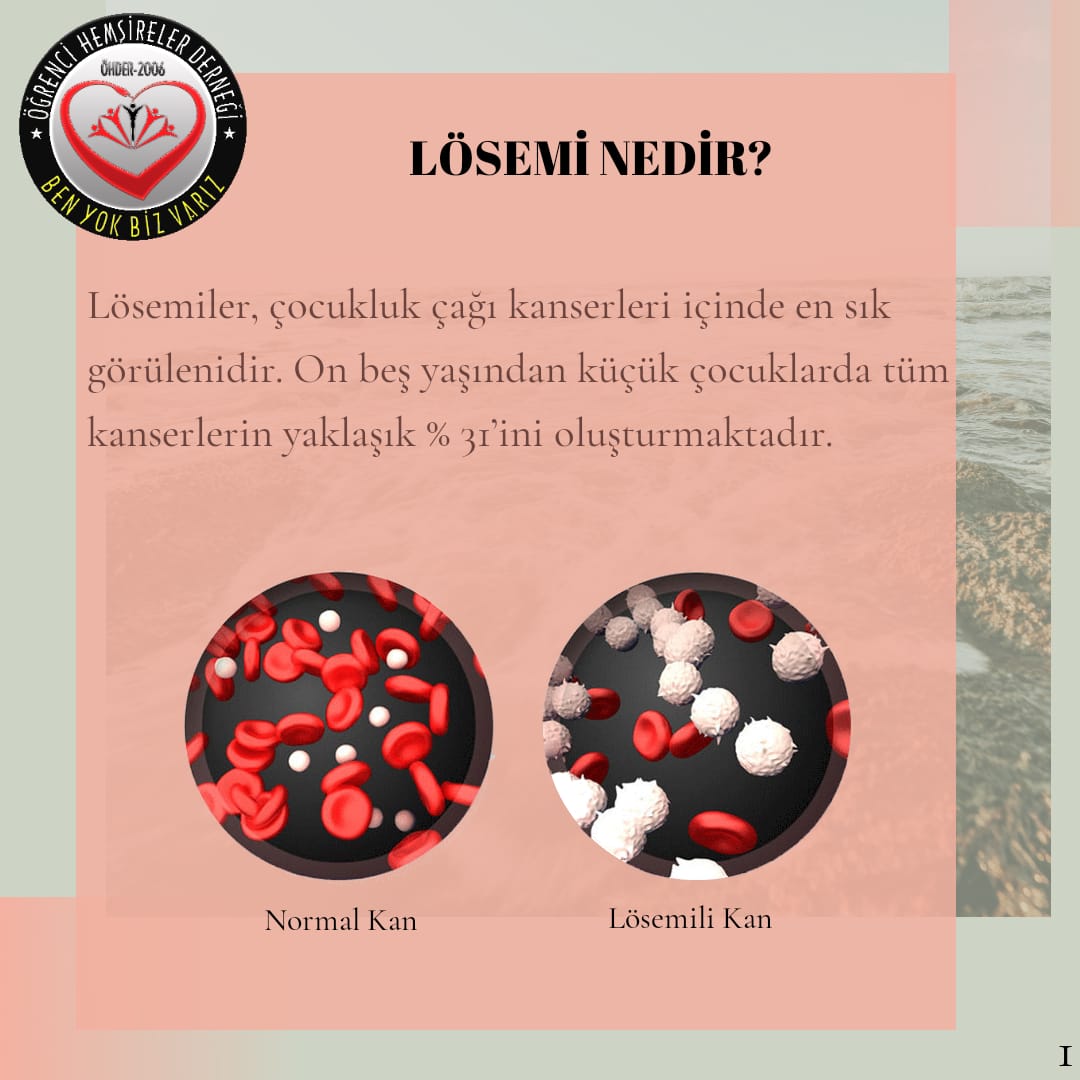 IkuOhder's tweet photo. 2-8 Kasım Lösemili Çocuklar Haftası☘
 #ohder #benyokbizvarız #birhemşirebinlercehayat #lösemi #lösemiliçocuklarhaftası #maskenitakfarkındalıkyarat #leukemia #leukemiaawareness #ogrencihemsireler https://t.co/i0rDj4Zz8n
