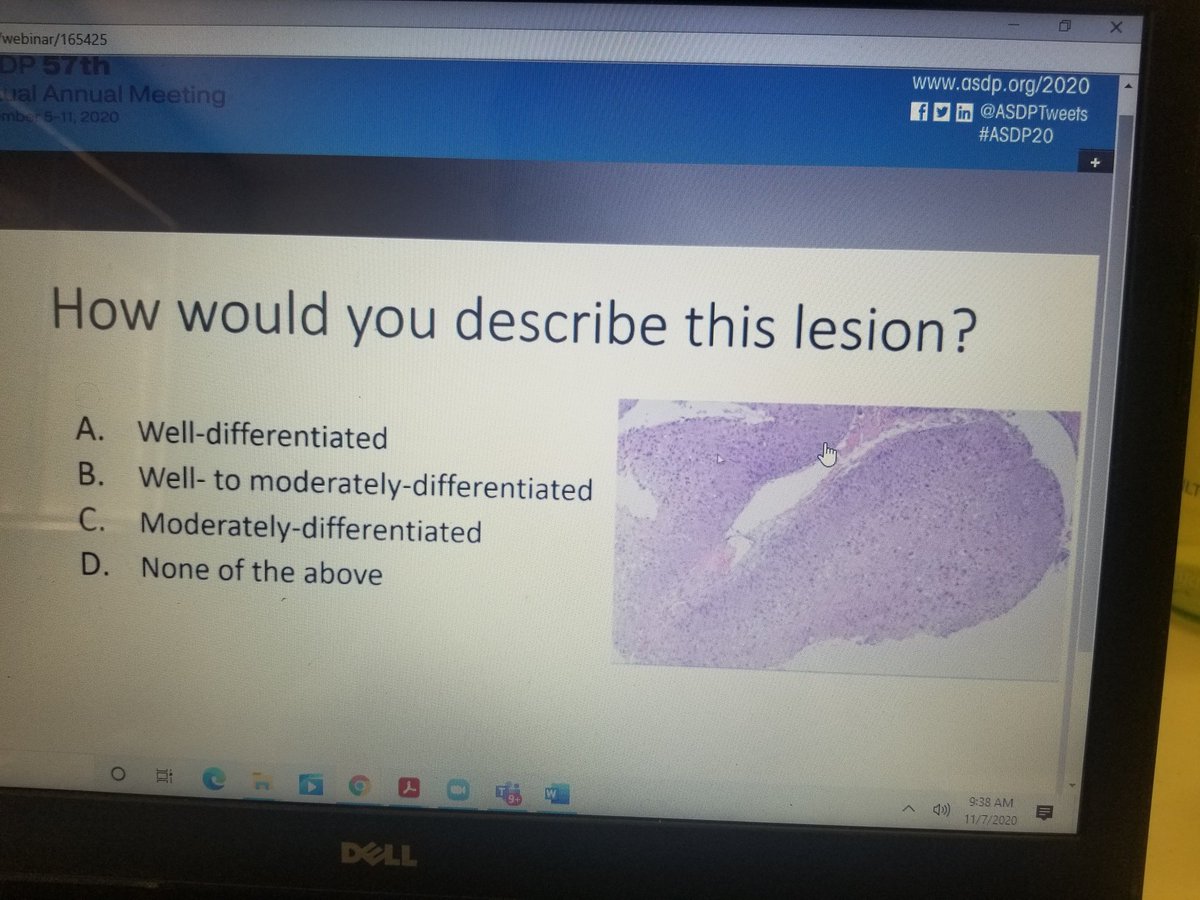 MitulModiMD's tweet image. #ASDP20 This is an excellent live session on practical approaches towards different cases diagnosis and hearing opinions from expert group panelists! Thank you @ASDPTweets for doing this, eduactional, innovative and practical! 🙏