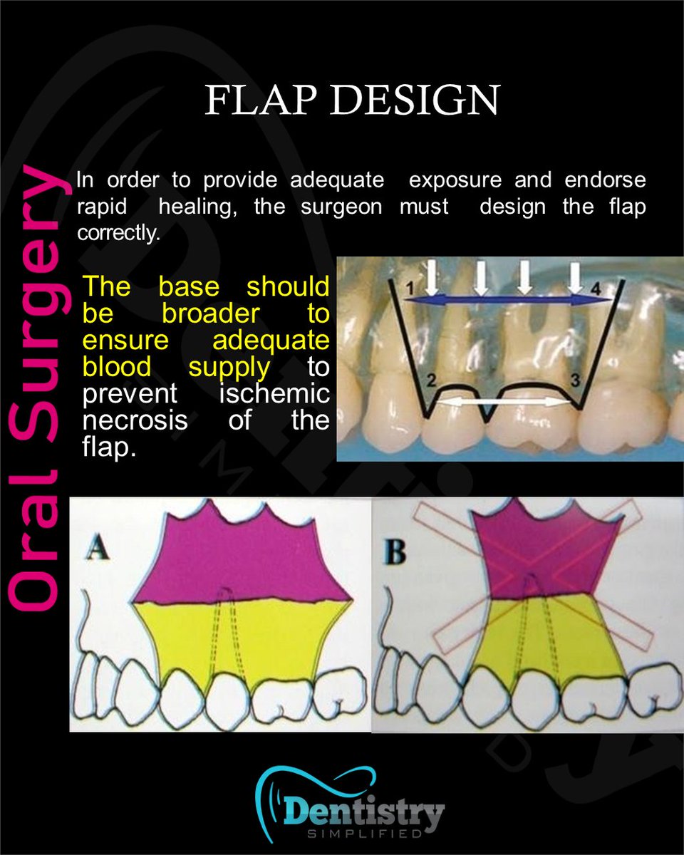 Dent_Simplified's tweet photo. Flap design: Adequate blood supply

#Dentistrty #Oral_Health #mds #dds #mdsprep  #mdspreparation  #next_exam #bds  #dental #dentistry #dentists #dentalstudent #dentalcare #nbe #neet_dental #oral_histology #Endodontics #Endo #oralmedicine #medicine #oralsurgery #OMFS #nbde https://t.co/fCnO82AmsX
