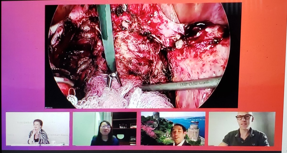 DrOshinowo's tweet photo. Great show of technique and anatomy @tedleefly. You made a very hard surgery look easy. #AAGL2020 #endometriosis #gynED https://t.co/cI3wCliRUq