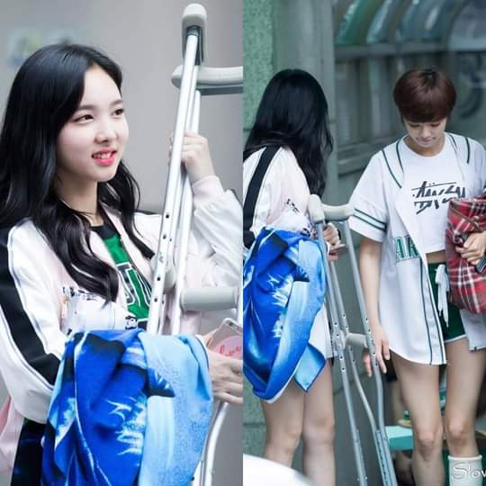 Nayeob helped Jeongyeon walked when her leg was injured and Nayeon also carried her crutches.