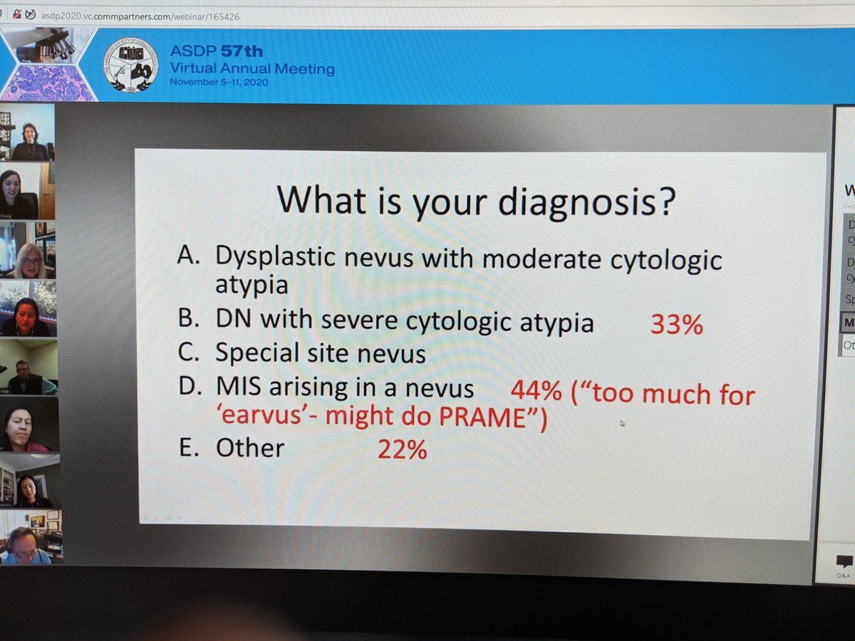 BloomquistSuzy's tweet image. Rapini once said there are so many special sites it would be easier to list the non-special sites. 😂 #ASDP20