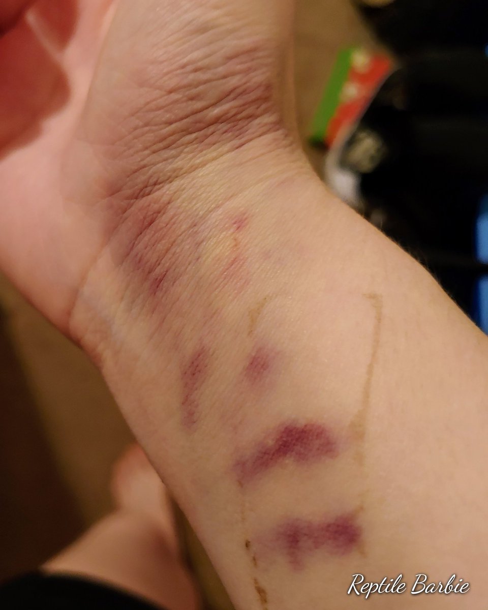ReptileBarbie's tweet photo. Arterial blood draws 💉 😫 = ouch!! https://t.co/D6beAnFLcG