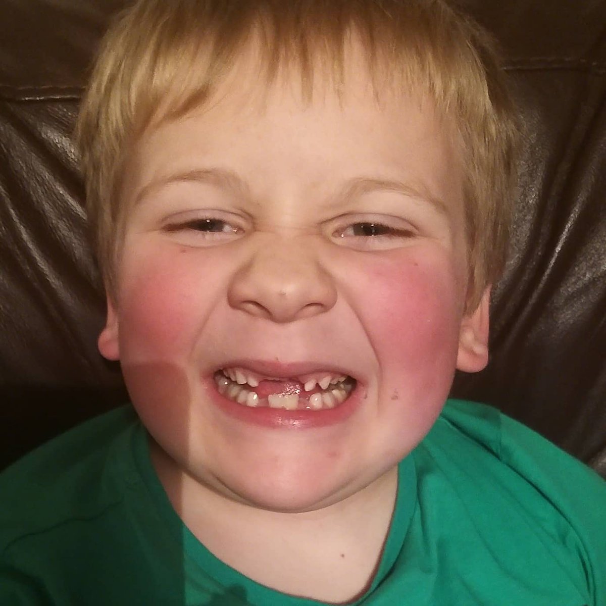 sam7886orourke's tweet photo. All i want for Christmas is my two front teeth! #growingup #lostbothteethinaweek #gummybear https://t.co/2SGqRkgSHB