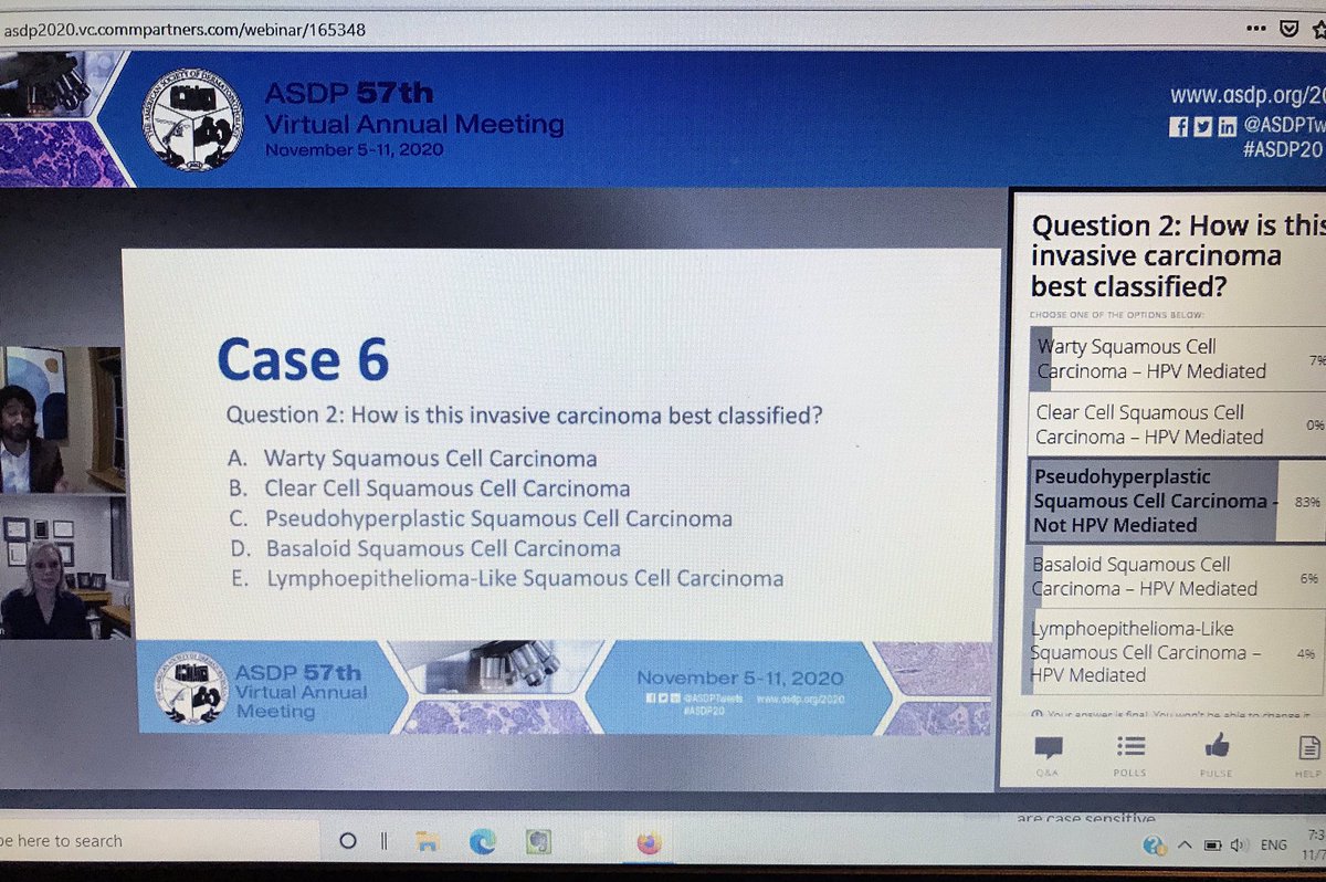 DrAldehyde's tweet image. Evening Slide Symposium is going on right now! 

Great cases with #dermpath and #GUpath combo presented by @kabeerkshah. 😆🔬#ASDP20 #ASDP2020