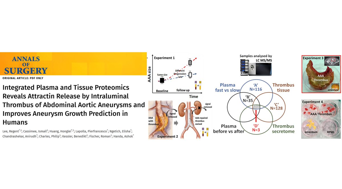 Another major milestone from my postdoctoral research! Attractin as a novel predictor of #abdominal_aortic_aneurysm growth. Most grateful for the funding support from <a href="/acmedsci/">Academy of Medical Sciences</a> and the team at <a href="/OxAAA_Study/">OxAAA Study</a> Open access <a href="/AnnalsofSurgery/">Annals of Surgery</a> and pubmed.ncbi.nlm.nih.gov/33065636/