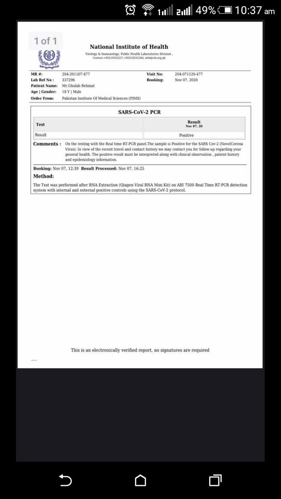 Nim30616277's tweet photo. @hamzashafqaat @hamzashafqaat  another case from department of governance and policy 2nd semester Bs 
#closenumlisb 
They still didnt sealed the departments and they are taking exams of all depts on same day there will be a mess in buses as well @hamzashafqaat @DhoIslamabad @TimesofIslambad https://t.co/1TY6DofbGx